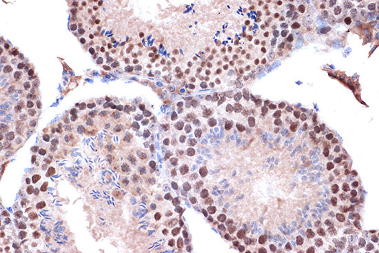 KIF4A Rabbit mAb
