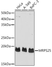 MRPS25 Rabbit pAb