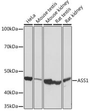 ASS1 Rabbit mAb