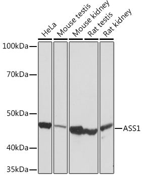 ASS1 Rabbit mAb