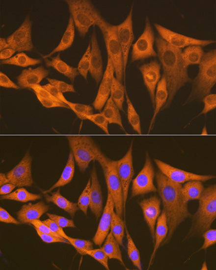 ASS1 Rabbit mAb