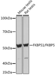 FKBP51/FKBP5 Rabbit mAb
