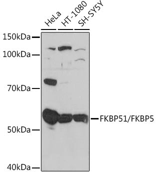 FKBP51/FKBP5 Rabbit mAb