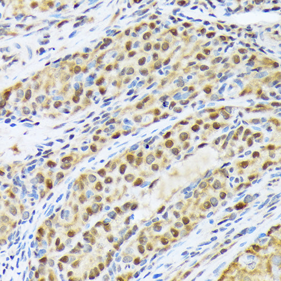 FKBP51/FKBP5 Rabbit mAb