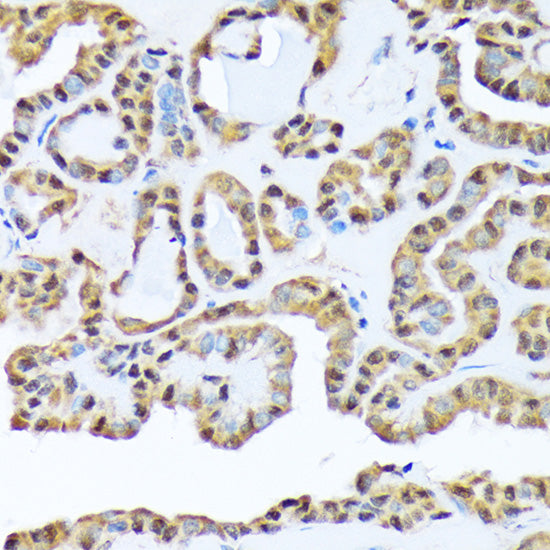 FKBP51/FKBP5 Rabbit mAb