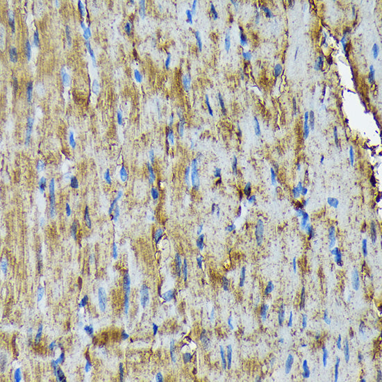 HSP20/HSPB6 Rabbit mAb