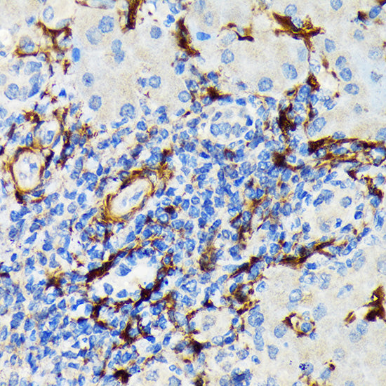 HSP20/HSPB6 Rabbit mAb