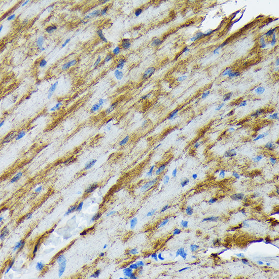 HSP20/HSPB6 Rabbit mAb