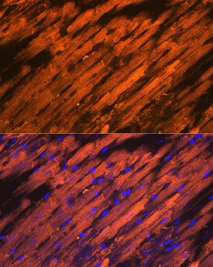 HSP20/HSPB6 Rabbit mAb