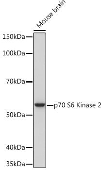 p70 S6 Kinase 2 Rabbit mAb
