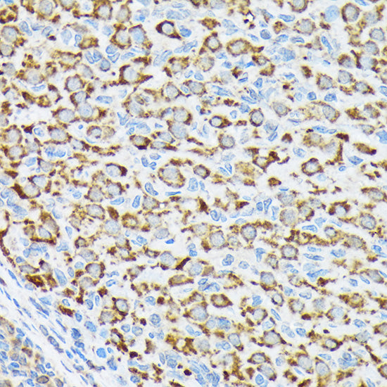 p70 S6 Kinase 2 Rabbit mAb