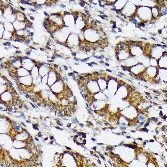 p70 S6 Kinase 2 Rabbit mAb
