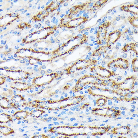 p70 S6 Kinase 2 Rabbit mAb