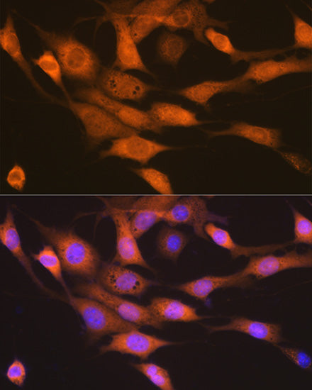 p70 S6 Kinase 2 Rabbit mAb