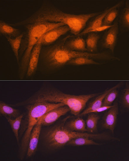 p70 S6 Kinase 2 Rabbit mAb