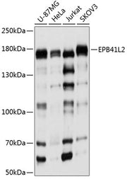 EPB41L2 Rabbit pAb
