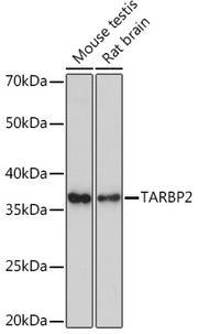 TARBP2 Rabbit mAb