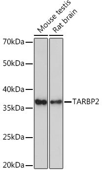 TARBP2 Rabbit mAb