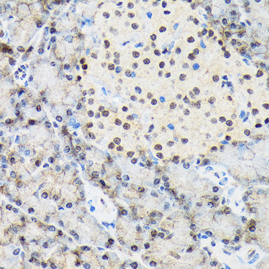 TARBP2 Rabbit mAb