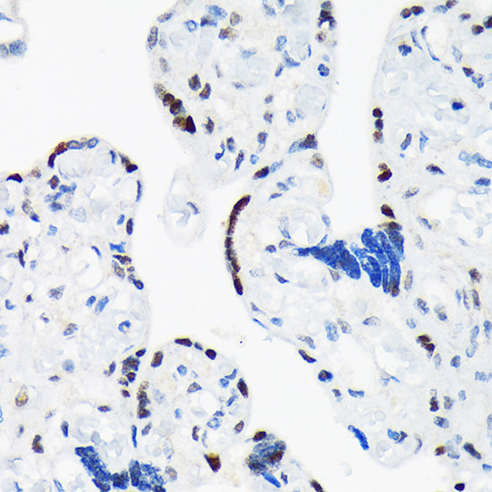 TARBP2 Rabbit mAb