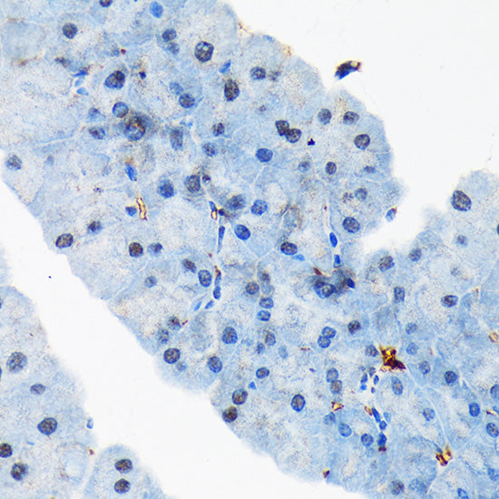 TARBP2 Rabbit mAb