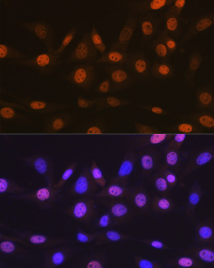 TARBP2 Rabbit mAb