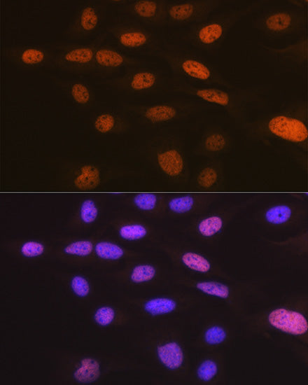 TARBP2 Rabbit mAb