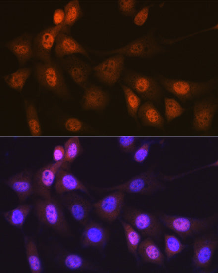 Musashi-1 (MSI1) Rabbit mAb