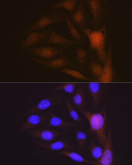 Musashi-1 (MSI1) Rabbit mAb