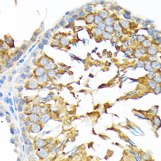 ALDH1A2 Rabbit mAb