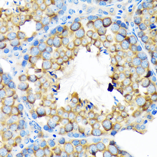 ALDH1A2 Rabbit mAb