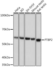 PTBP2 Rabbit mAb