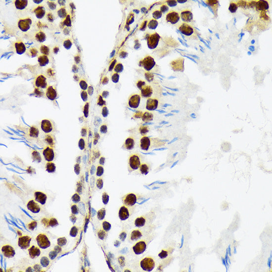 PTBP2 Rabbit mAb