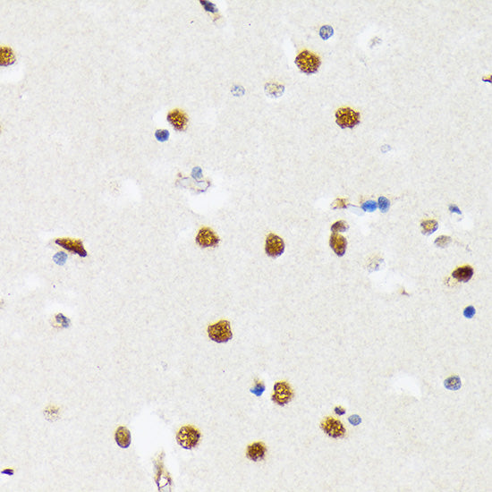 PTBP2 Rabbit mAb
