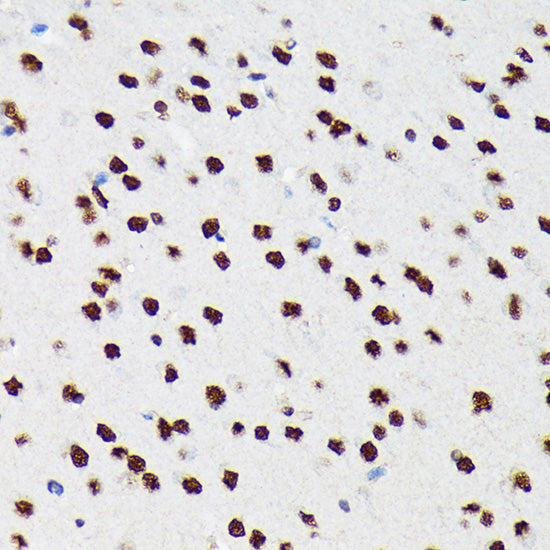 PTBP2 Rabbit mAb