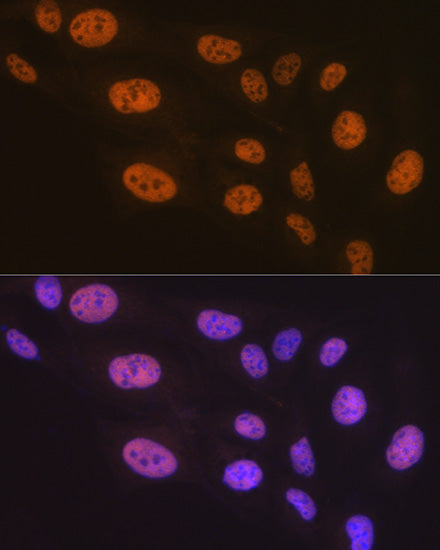 PTBP2 Rabbit mAb