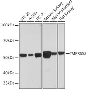 TMPRSS2 Rabbit mAb