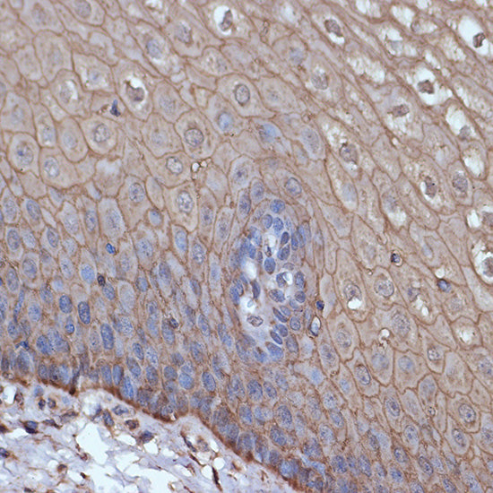 TMPRSS2 Rabbit mAb