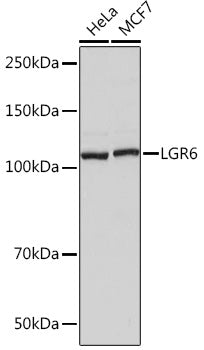 LGR6 Rabbit mAb
