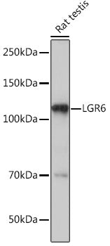 LGR6 Rabbit mAb