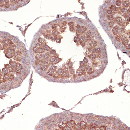 NCK1 Rabbit mAb