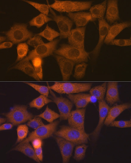 NCK1 Rabbit mAb