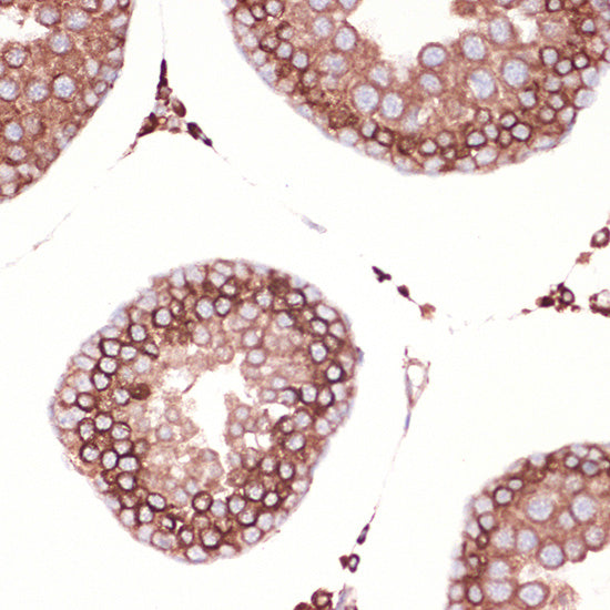Peroxiredoxin 4 (PRDX4) Rabbit mAb