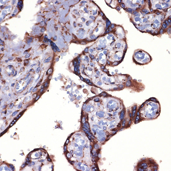 Peroxiredoxin 4 (PRDX4) Rabbit mAb