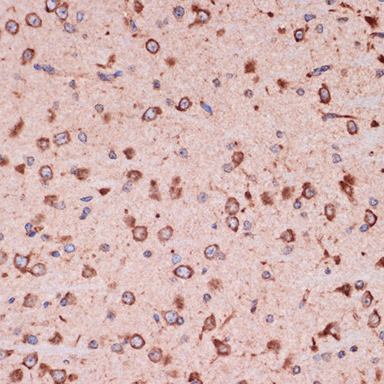 Peroxiredoxin 4 (PRDX4) Rabbit mAb