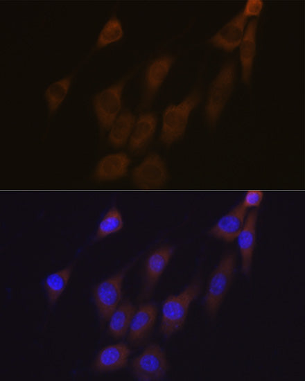 Peroxiredoxin 4 (PRDX4) Rabbit mAb
