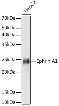 Ephrin A1 Rabbit mAb