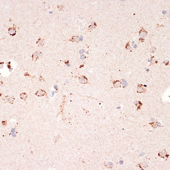 Ephrin A1 Rabbit mAb