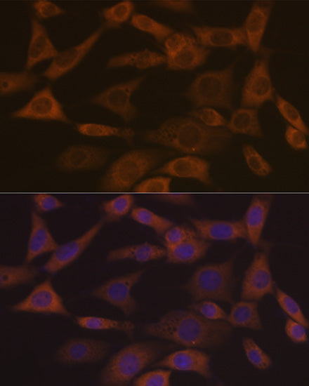 Ephrin A1 Rabbit mAb