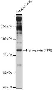 Hemopexin (HPX) Rabbit mAb